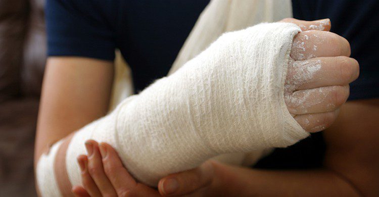 Fractura (iStock)