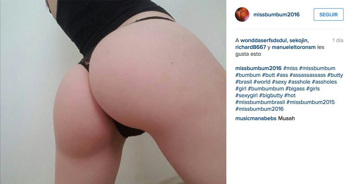 Cirugías y silicona (Instagram)