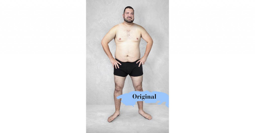 Modelo original (onlinedoctor.superdrug.com)
