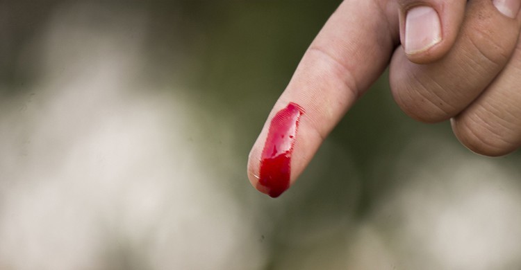 Heridas con hemorragia (Pixabay)