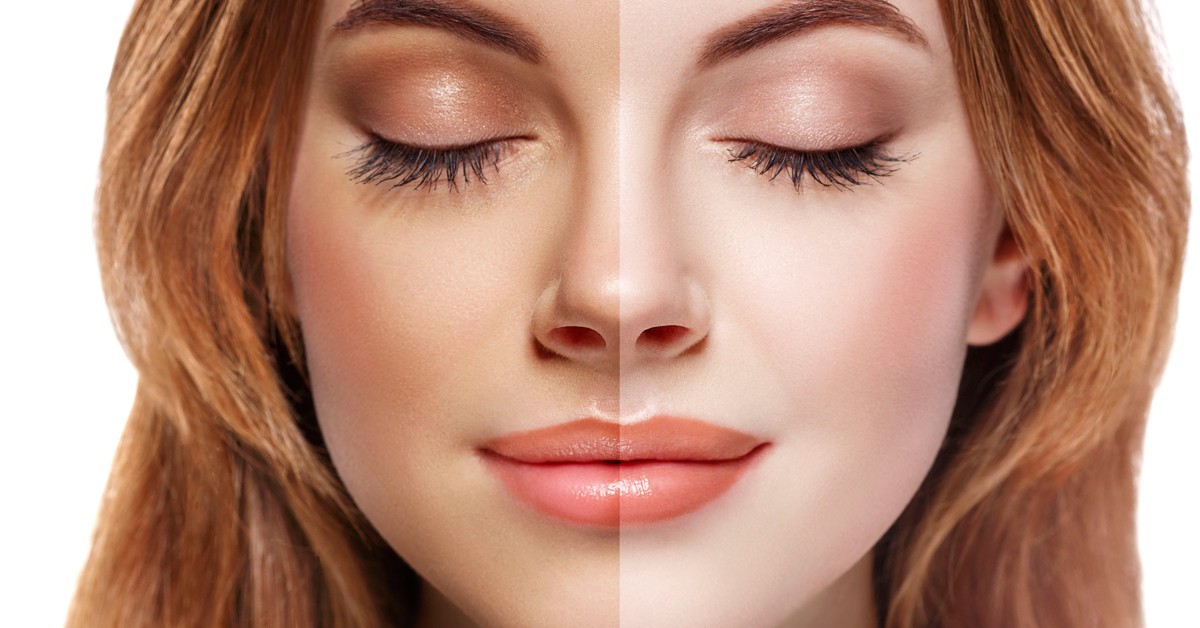 Fotografía de una mujer con dos tonos de piel en su rostro