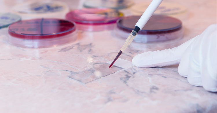 2. La melioidosis