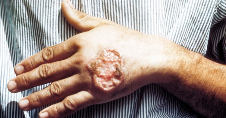 enfermedades latinoamerica