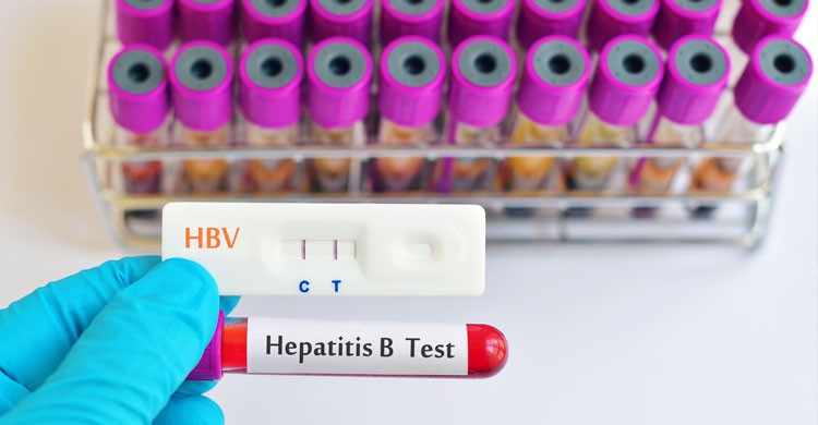 4. Hepatitis B